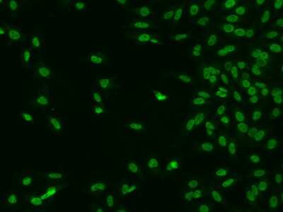 Immunocytochemistry/ Immunofluorescence CTDSP2 Antibody