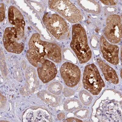 Immunohistochemistry: CTDSP2 Antibody [NBP2-49053] - Staining of human kidney shows strong cytoplasmic positivity in cells in tubules.