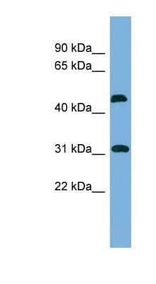 Western Blot: CTDSP2 Antibody [NBP1-55471] - Human kidney lysate, concentration 0.2-1 ug/ml.