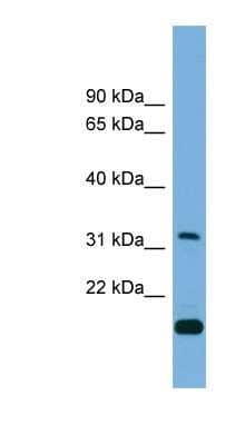 Western Blot: CTDSP2 Antibody [NBP1-56566] - RPMI 8226 cell lysate, concentration 0.2-1 ug/ml.