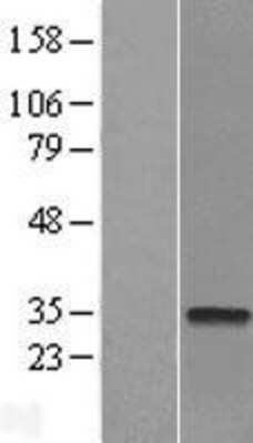 Western Blot CTDSP2 Overexpression Lysate