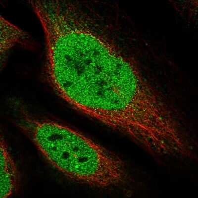 Immunocytochemistry/Immunofluorescence: CTDSPL2 Antibody [NBP1-91814] - Staining of human cell line U-2 OS shows localization to nucleoplasm. Antibody staining is shown in green.