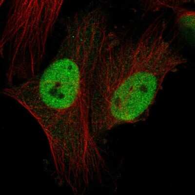 Immunocytochemistry/ Immunofluorescence CTDSPL2 Antibody - BSA Free