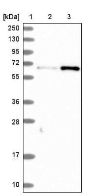 Western Blot: CTDSPL2 Antibody [NBP1-91814] - Lane 1: Marker  [kDa] 250, 130, 95, 72, 55, 36, 28, 17, 10.  Lane 2: Human cell line RT-4.  Lane 3: Human cell line U-251MG sp