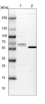 Western Blot CTDSPL2 Antibody - BSA Free
