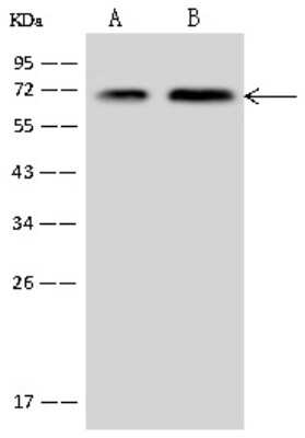 Western Blot: CTDSPL2 Antibody [NBP2-97397] - Anti-CTDSPL2 rabbit polyclonal antibody at 1:500 dilution. Lane A: MCF-7 Whole Cell Lysate Lane B: U-251 MG Whole Cell Lysate Lysates/proteins at 30 ug per lane. Secondary Goat Anti-Rabbit IgG (H+L)/HRP at 1/10000 dilution. Developed using the ECL technique. Performed under reducing conditions. Predicted band size: 53 kDa. Observed band size: 70 kDa