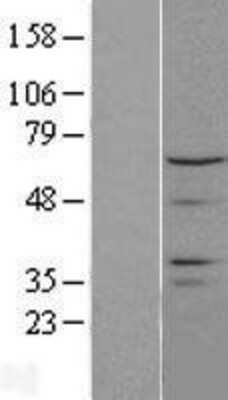 Western Blot: CTDSPL2 Overexpression Lysate (Adult Normal) [NBL1-09570] - Western Blot experiments.  Left-Control; Right -Over-expression Lysate for CTDSPL2