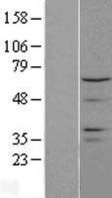 Western Blot CTDSPL2 Overexpression Lysate