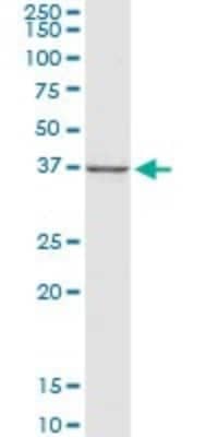 Western Blot: CTGF/CCN2 Antibody (2C11) [H00001490-M01] - CTGF monoclonal antibody (M01), clone 2C11. Analysis of CTGF expression in human liver.