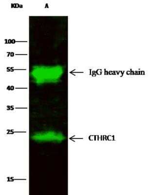 Immunoprecipitation: CTHRC1 Antibody (166) [NBP2-89947] - Lane A:0.5 mg HepG2 Whole Cell Lysate2 uL anti-CTHRC1 rabbit monoclonal antibody and 15 ul of 50 % Protein G agarose.Primary antibody:Anti-CTHRC1 rabbit monoclonal antibody,at 1:200 dilution Secondary antibody:Dylight 800-labeled antibody to rabbit IgG (H+L), at 1:5000 dilution Developed using the odssey technique.Performed under reducing conditions.Predicted band size: 26 kDaObserved band size: 23 kDa