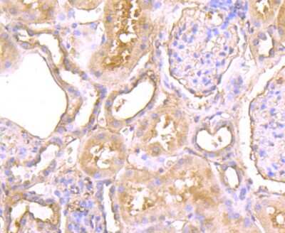 Immunohistochemistry-Paraffin: CTHRC1 Antibody (5H1) [NBP2-75454] - Analysis of paraffin-embedded human kidney tissue using anti-CTHRC1 antibody. Counter stained with hematoxylin.