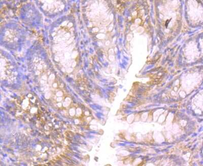 Immunohistochemistry-Paraffin: CTHRC1 Antibody (5H1) [NBP2-75454] - Analysis of paraffin-embedded rat large intestine tissue using anti-CTHRC1 antibody. Counter stained with hematoxylin.