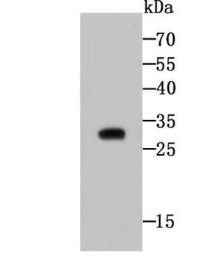 Western Blot: CTHRC1 Antibody (5H1) [NBP2-75454] - Analysis of CTHRC1 on CTHRC1 recombinant protein using anti-CTHRC1 antibody at 1/500 dilution.