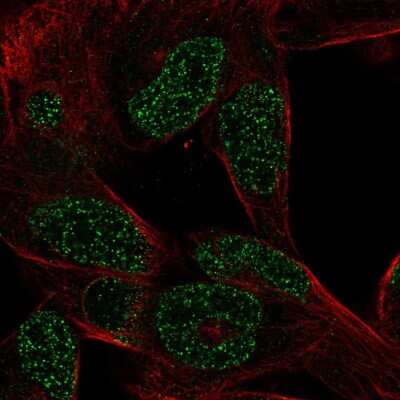 Immunocytochemistry/Immunofluorescence: CTHRC1 Antibody [NBP2-57734] - Staining of human cell line RH-30 shows localization to nucleoplasm.