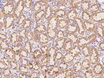 Immunohistochemistry-Paraffin: CTHRC1 Antibody [NBP2-98449] - Immunochemical staining of rat CTHRC1 in rat kidney with rabbit polyclonal antibody at 1:200 dilution, formalin-fixed paraffin embedded sections.