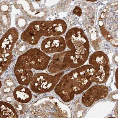 Immunohistochemistry-Paraffin: CTIF Antibody [NBP1-83008] - Staining of human kidney shows strong cytoplasmic positivity in tubule cells.