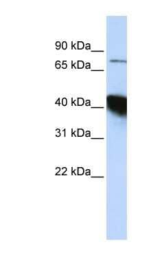 Western Blot: CTIF Antibody [NBP1-57423] - HepG2 cell lysate, concentration 0.2-1 ug/ml.