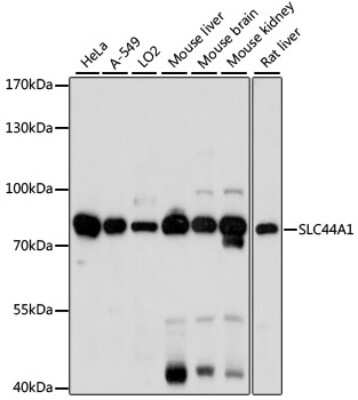 Western Blot: CTL1/SLC44A1 Antibody [NBP2-92231] - Analysis of extracts of various cell lines, using CTL1/SLC44A1 at 1:1000 dilution. Secondary antibody: HRP Goat Anti-Rabbit IgG (H+L) at 1:10000 dilution. Lysates/proteins: 25ug per lane. Blocking buffer: 3% nonfat dry milk in TBST. Detection: ECL Basic Kit . Exposure time: 30s.