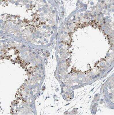 Immunohistochemistry-Paraffin CTL5 Antibody - BSA Free