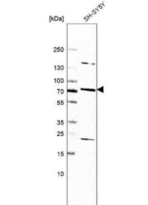 Western Blot CTL5 Antibody - BSA Free