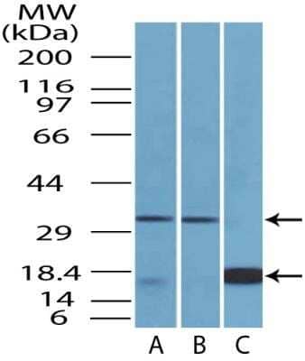 Western Blot: CTLA-4 Antibody (37B3D8.2F2) - Azide and BSA Free [NBP2-80683] - Analysis of CTLA-4 protein on (A) mouse Kidney lysate (B) human Kidney lysate and on (C) partial recombinant protein using CTLA-4 monoclonal antibody at a concentration of 2 ug/ml. Image from the standard format of this antibody.