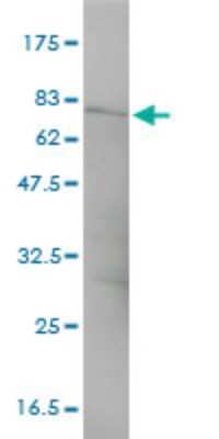 Western Blot: CTNNA3 Antibody (3F4-1B11) [H00029119-M01] - CTNNA3 monoclonal antibody (M01), clone 3F4-1B11 Analysis of CTNNA3 expression in HepG2.