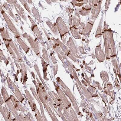 Immunohistochemistry-Paraffin: CTNNA3 Antibody [NBP2-49348] - Staining of human heart muscle shows high expression.