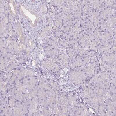 Immunohistochemistry-Paraffin: CTNNA3 Antibody [NBP2-49348] - Staining of human pancreas shows low expression as expected.