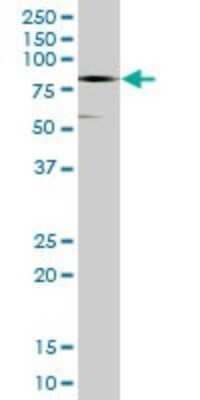 Western Blot: CTNNA3 Antibody [H00029119-B01P] - Analysis of CTNNA3 expression in rat brain.