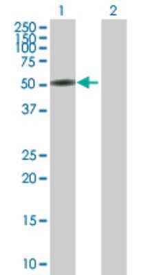 Western Blot: CTNNA3 Antibody [H00029119-B01P] - Analysis of CTNNA3 expression in transfected 293T cell line by CTNNA3 polyclonal antibody.  Lane 1: CTNNA3 transfected lysate(56.76 KDa). Lane 2: Non-transfected lysate.