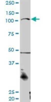 Western Blot: CTNNA3 Antibody [H00029119-D01P] - Analysis of CTNNA3 expression in mouse spleen.