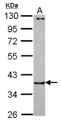 Western Blot: CTNNA3 Antibody [NBP2-16030] - Sample (30 ug of whole cell lysate) A: HeLa 10% SDS PAGE gel, diluted at 1:1000.