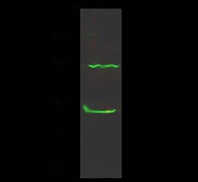 Western Blot: CTNNA3 Antibody [NBP2-99083] - Anti-CTNNA3 rabbit polyclonal antibody at 1:500 dilution. Lane A: HeLa Whole Cell Lysate. Lysates/proteins at 30 ug per lane. Secondary Goat Anti- Rabbit  IgG H&L (Dylight 800)  at 1/10000 dilution. Developed using the Odyssey technique. Performed under reducing conditions. Predicted band size: 84 kDa. Observed band size: 87 kDa (We are unsure as to the identity of these extra bands).