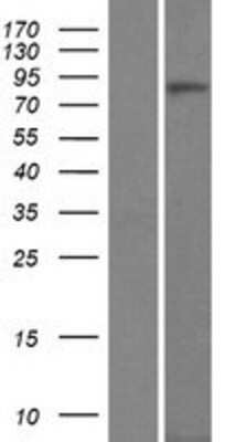 Western Blot: CTNNA3 Overexpression Lysate (Adult Normal) [NBP2-07428] Left-Empty vector transfected control cell lysate (HEK293 cell lysate); Right -Over-expression Lysate for CTNNA3.