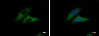 Immunocytochemistry/ Immunofluorescence CTNNAL1 Antibody - BSA Free