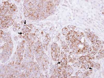 Immunohistochemistry-Paraffin CTNNAL1 Antibody - BSA Free