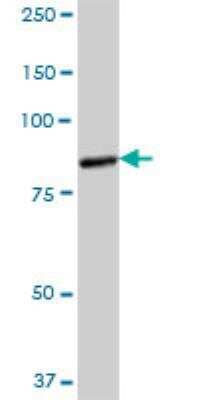 Western Blot: CTNNAL1 Antibody [H00008727-B01P] - CTNNAL1 MaxPab polyclonal antibody. Western Blot analysis of CTNNAL1 expression in human colon.