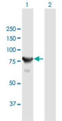 Western Blot: CTNNAL1 Antibody [H00008727-B01P] - Analysis of CTNNAL1 expression in transfected 293T cell line by CTNNAL1 polyclonal antibody.  Lane 1: CTNNAL1 transfected lysate(80.74 KDa). Lane 2: Non-transfected lysate.