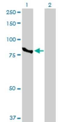 Western Blot: CTNNAL1 Antibody [H00008727-D01P] - Analysis of CTNNAL1 expression in transfected 293T cell line by CTNNAL1 polyclonal antibody.Lane 1: CTNNAL1 transfected lysate(81.90 KDa).Lane 2: Non-transfected lysate.