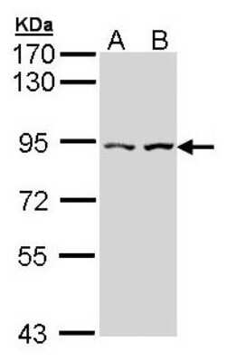 Western Blot: CTNNAL1 Antibody [NBP1-33341] - Sample (30 ug of whole cell lysate) A: Hela B: Hep G2 7. 5% SDS PAGE; antibody diluted at 1:1000.