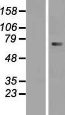 Western Blot CTNNAL1 Overexpression Lysate