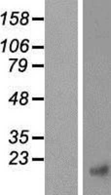 Western Blot: CTNNBIP1 Overexpression Lysate (Adult Normal) [NBP2-06663] Left-Empty vector transfected control cell lysate (HEK293 cell lysate); Right -Over-expression Lysate for CTNNBIP1.