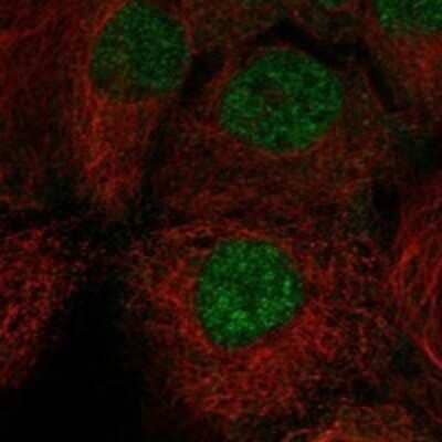 Immunocytochemistry/Immunofluorescence: CTNNBL1 Antibody [NBP3-17825] - Staining of human cell line CACO-2 shows localization to nucleoplasm.