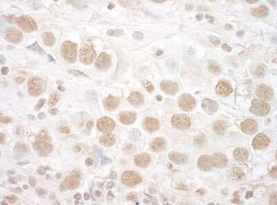 <b>Independent Antibodies Validation and Biological Strategies Validation.</b>Immunohistochemistry-Paraffin: CTNNBL1 Antibody [NBP1-42679] - Sample: FFPE section of human testicular seminoma. Antibody: Affinity purified rabbit anti-CTNNBL1 used at a dilution of 1:200 (1ug/ml). Detection: DAB