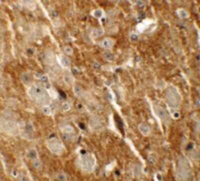 Immunohistochemistry: CTNNBL1 Antibody [NBP1-76543] - Immunohistochemistry of CTNNBL1 in mouse brain tissue with CTNNBL1 antibody at 5 ug/mL.