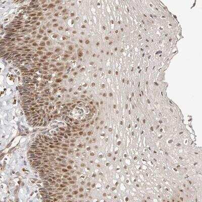 Immunohistochemistry: CTNNBL1 Antibody [NBP1-88298] - Staining of human esophagus shows moderate nuclear positivity in squamous epithelial cells.