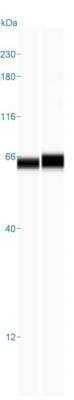 Simple Western: CTNNBL1 Antibody [NBP1-88298] - Simple Western lane view shows a specific band for CTNNBL1 in 0.2 mg/ml of HCT 116 (left) and SW480 (right) lysate(s). This experiment was performed under reducing conditions using the 12-230 kDa separation systems.