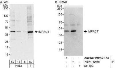 Western Blot: CTNNBL1 Antibody [NBP1-42679] - Whole cell lysate from HeLa (5, 15 and 50 mcg for WB; 1 mg for IP, 20% of IP loaded), 293T (T; 50 mcg), and mouse NIH3T3 (M; 50 mcg) cells. Affinity purified rabbit anti-CTNNBL1 antibody used for WB at 0.04 mcg/ml (A) and 0.4 mcg/ml (B) and used for IP at 3 mcg/mg lysate.  CTNNBL1 was also immunoprecipitated, albeit inefficiently, by another rabbit anti-CTNNBL1 antibody , which recognizes a downstream epitope.