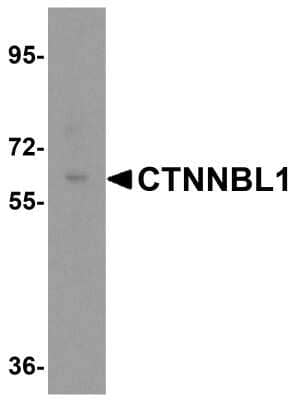 Western Blot: CTNNBL1 Antibody [NBP1-76543] - Analysis in human brain tissue lysate with antibody at 0.5 ug/mL.