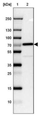 Western Blot: CTNNBL1 Antibody [NBP1-88298] - Lane 1: Marker  [kDa] 250, 130, 100, 70, 55, 35, 25, 15, 10.  Lane 2: CACO-2